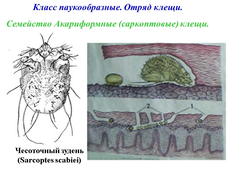 Класс паукообразные. Отряд клещи. Семейство Акариформные (саркоптовые) клещи. Чесоточный зудень (Sarcoptes scabiei)